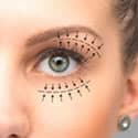 blefaroplastia em formosa icon w